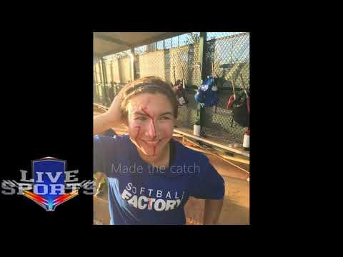 Video of Nadia gets 15 Stitches...plays the next day